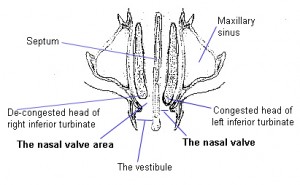 Nasal Resistance